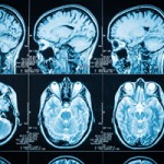 Neuroscientific Evidence in the Courtroom