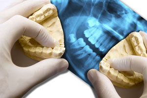hands show molar teeth over x-ray dental scan